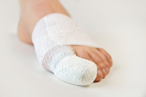 Buddy Taping for Broken Toes