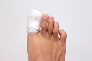 Why You Should Never Ignore Any Fracture in Your Toe